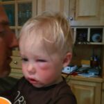 Isaac's first trip to CHEO... for a black fly bite!!